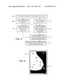 PROCESSING MEDICAL IMAGES OF THE BREAST TO DETECT ANATOMICAL ABNORMALITIES THEREIN diagram and image