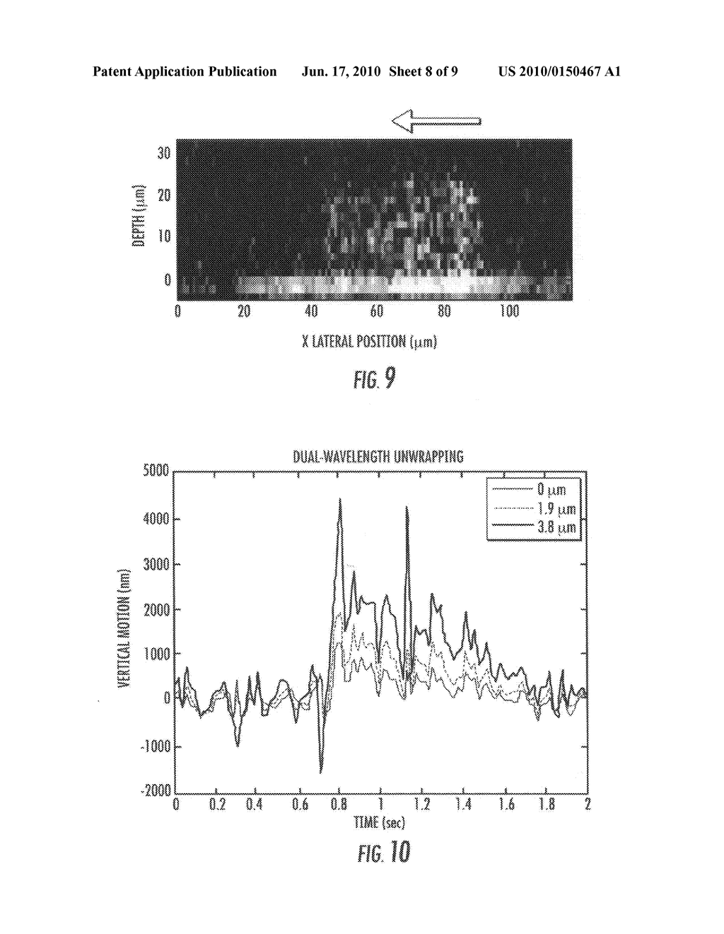 Methods, systems, and computer readable media for synthetic wavelength-based phase unwrapping in optical coherence tomography and spectral domain phase microscopy - diagram, schematic, and image 09