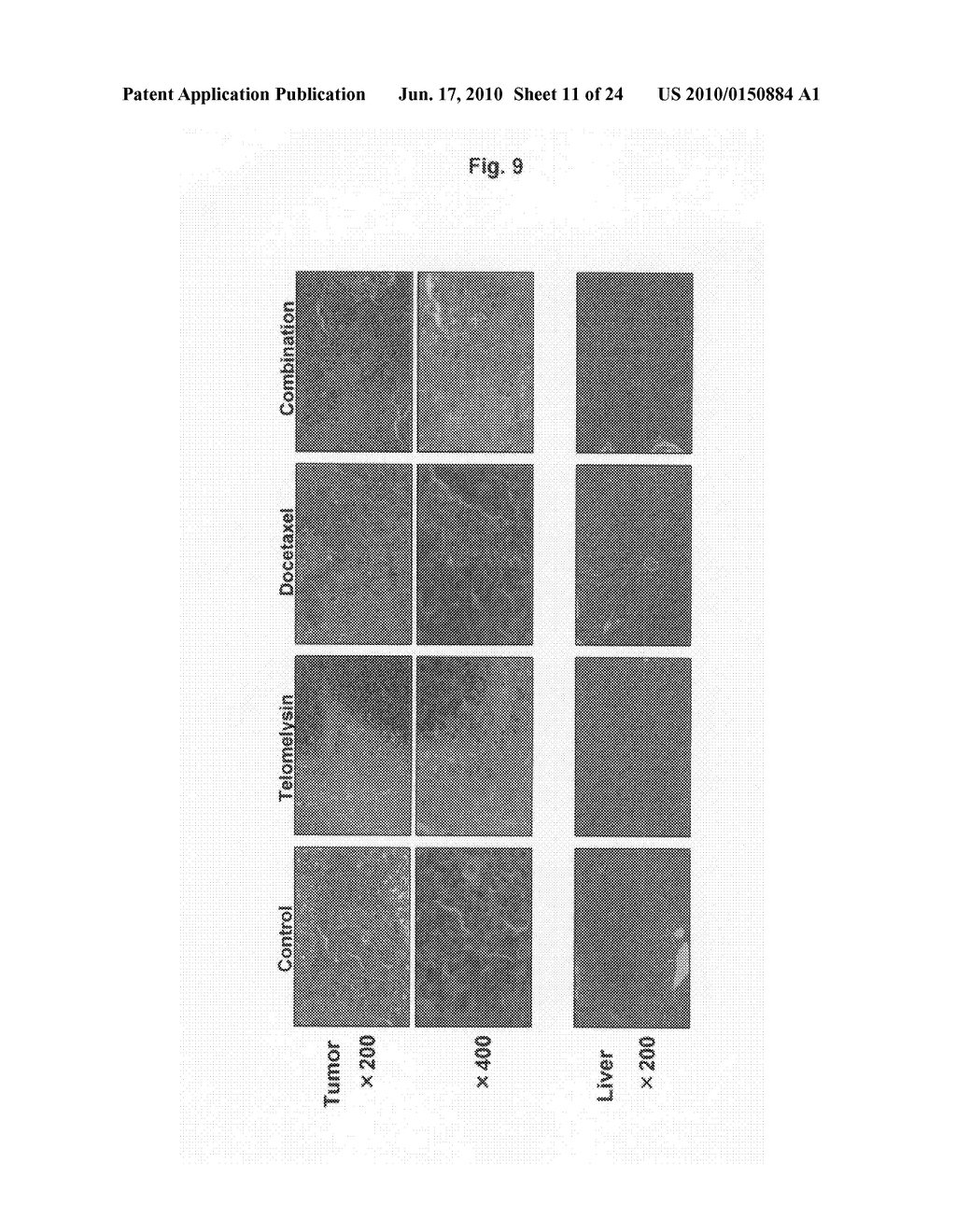 Anticancer Agent to Be Combined with Telomelysin - diagram, schematic, and image 12