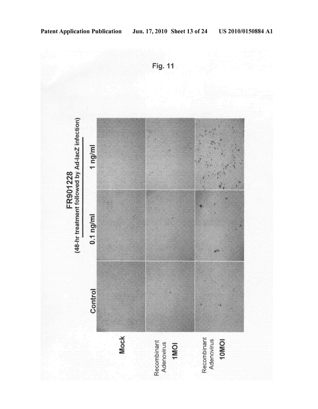 Anticancer Agent to Be Combined with Telomelysin - diagram, schematic, and image 14