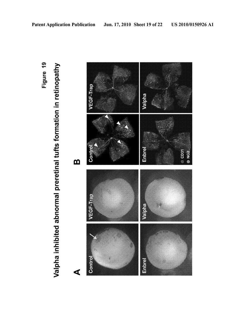 FUSION PROTEIN CAPABLE OF BINDING VEGF-A AND TNF-ALPHA - diagram, schematic, and image 20