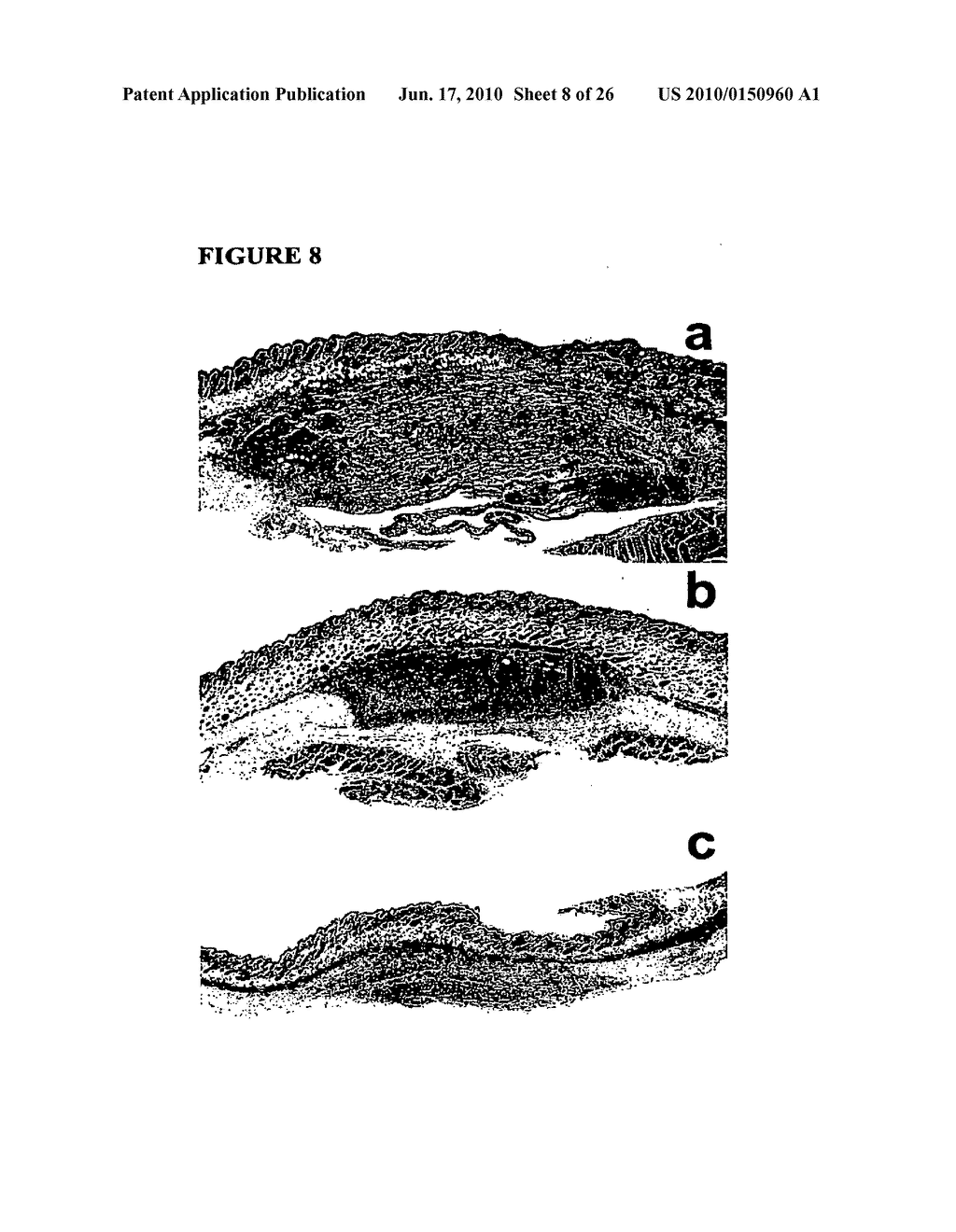 COMPOSITIONS AND METHODS FOR CHITOSAN ENHANCED IMMUNE RESPONSE - diagram, schematic, and image 09