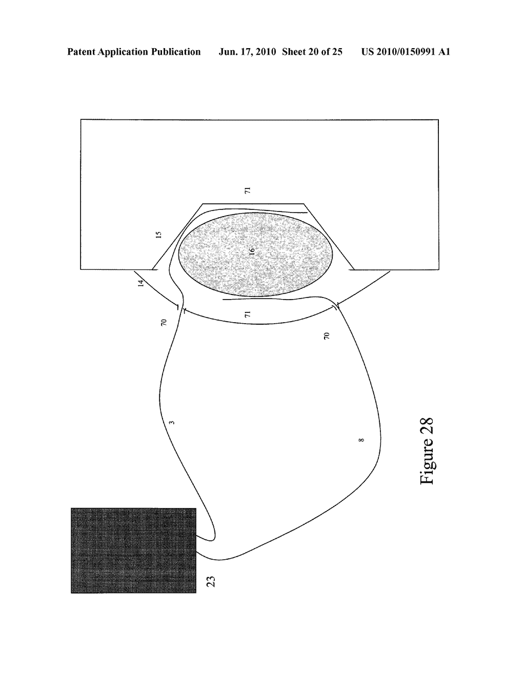 Combination Wound Therapy - diagram, schematic, and image 21