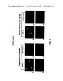 CANCER THERAPY SENSITIZER diagram and image