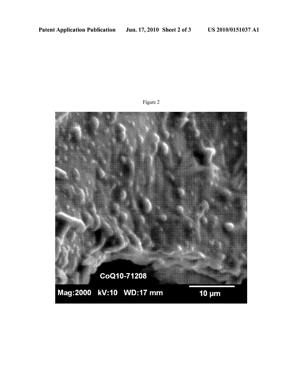 METHOD FOR THE PREPARATION OF NANOPARTICLES CONTAINING A POORLY WATER-SOLUBLE PHARMACEUTICALLY ACTIVE COMPOUND - diagram, schematic, and image 03