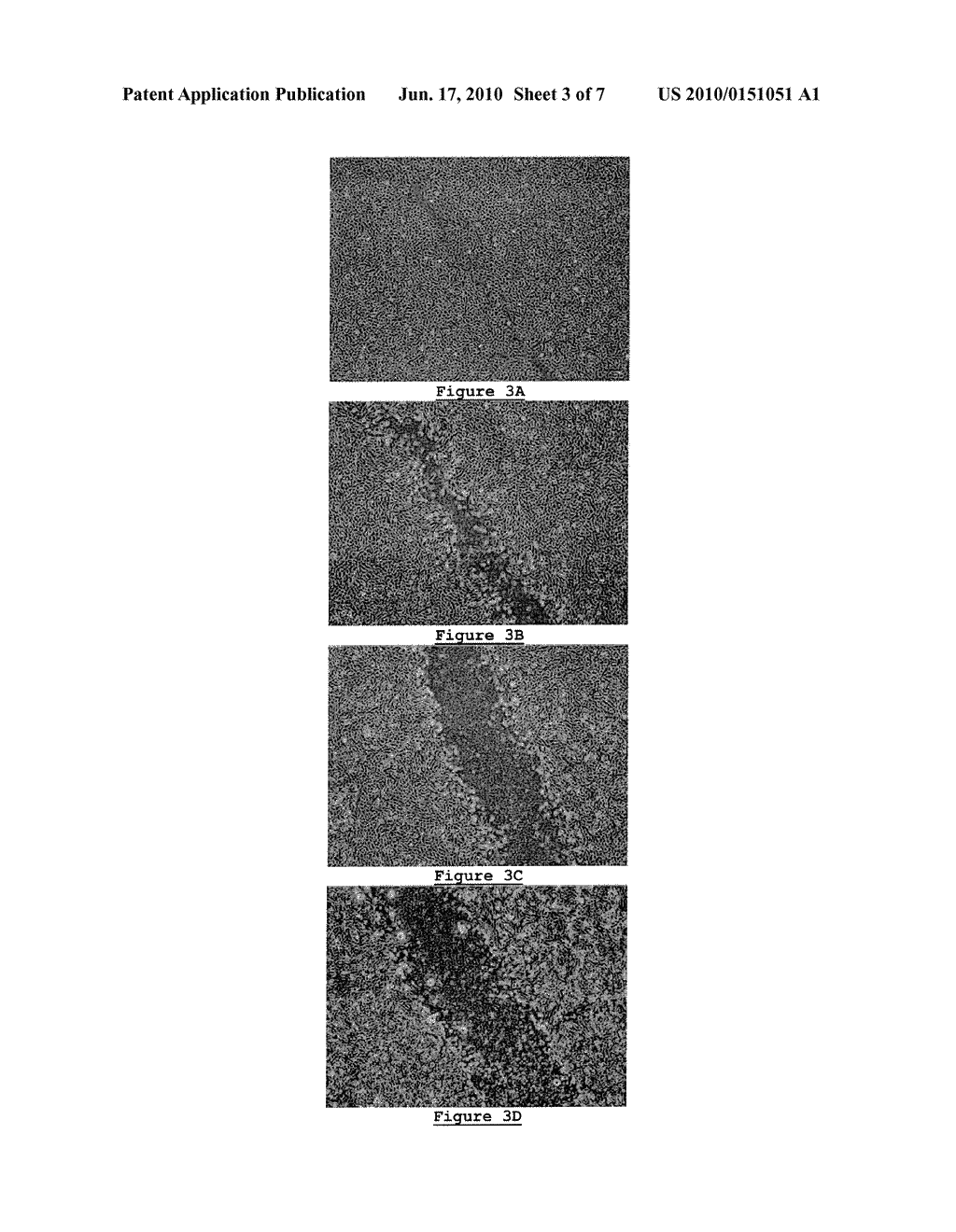 ANTI-TUMOR DRUG, MEDICAMENT, COMPOSITION, AND USE THEREOF - diagram, schematic, and image 04