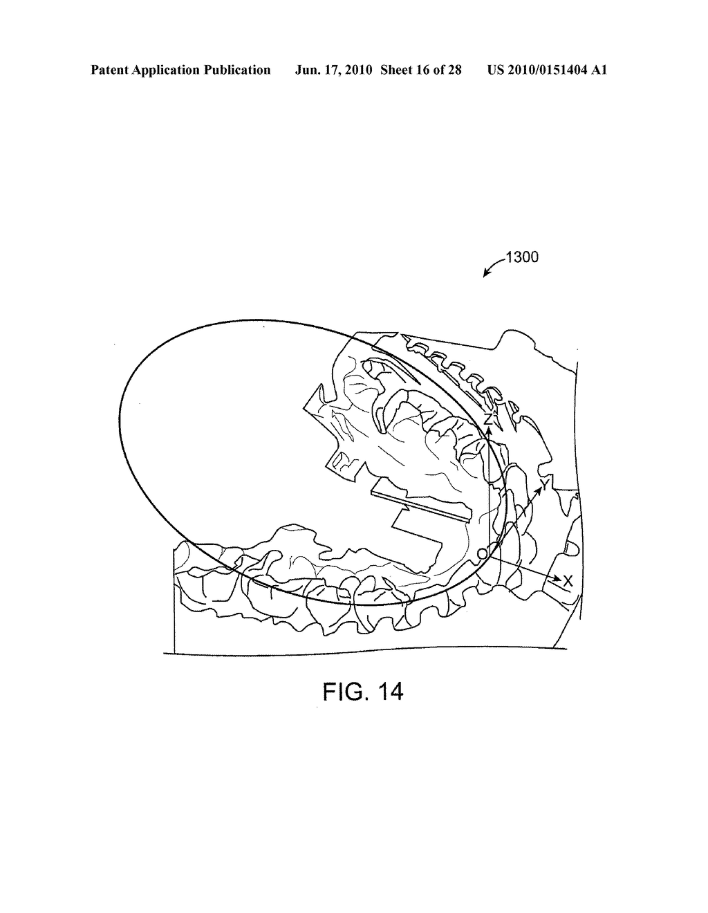 TOOTH MOVEMENT MEASUREMENT BY AUTOMATIC IMPRESSION MATCHING - diagram, schematic, and image 17