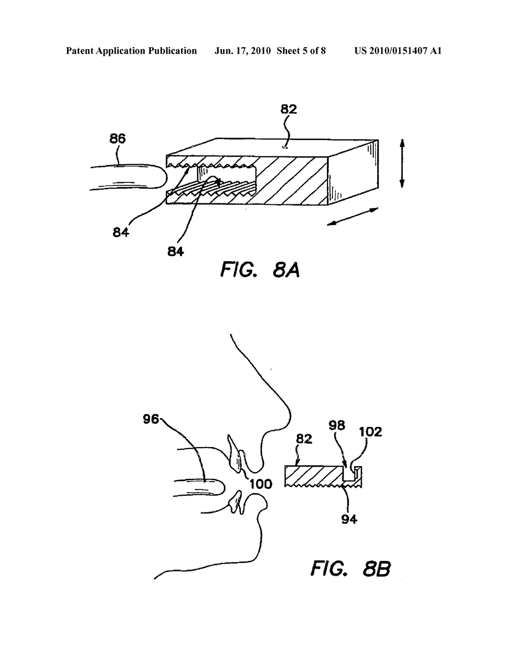 DEVICE HAVING ACTIVATED TEXTURED SURFACES FOR TREATING ORAL TISSUE - diagram, schematic, and image 06