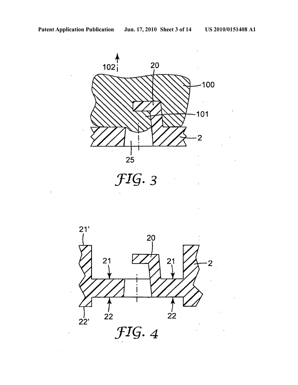 DENTAL IMPRESSION TRAY - diagram, schematic, and image 04