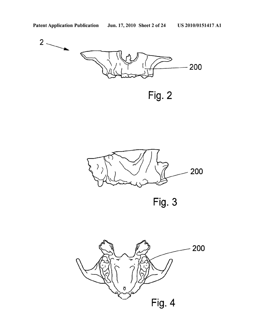 METHOD AND SYSTEM FOR DENTAL PLANNING - diagram, schematic, and image 03