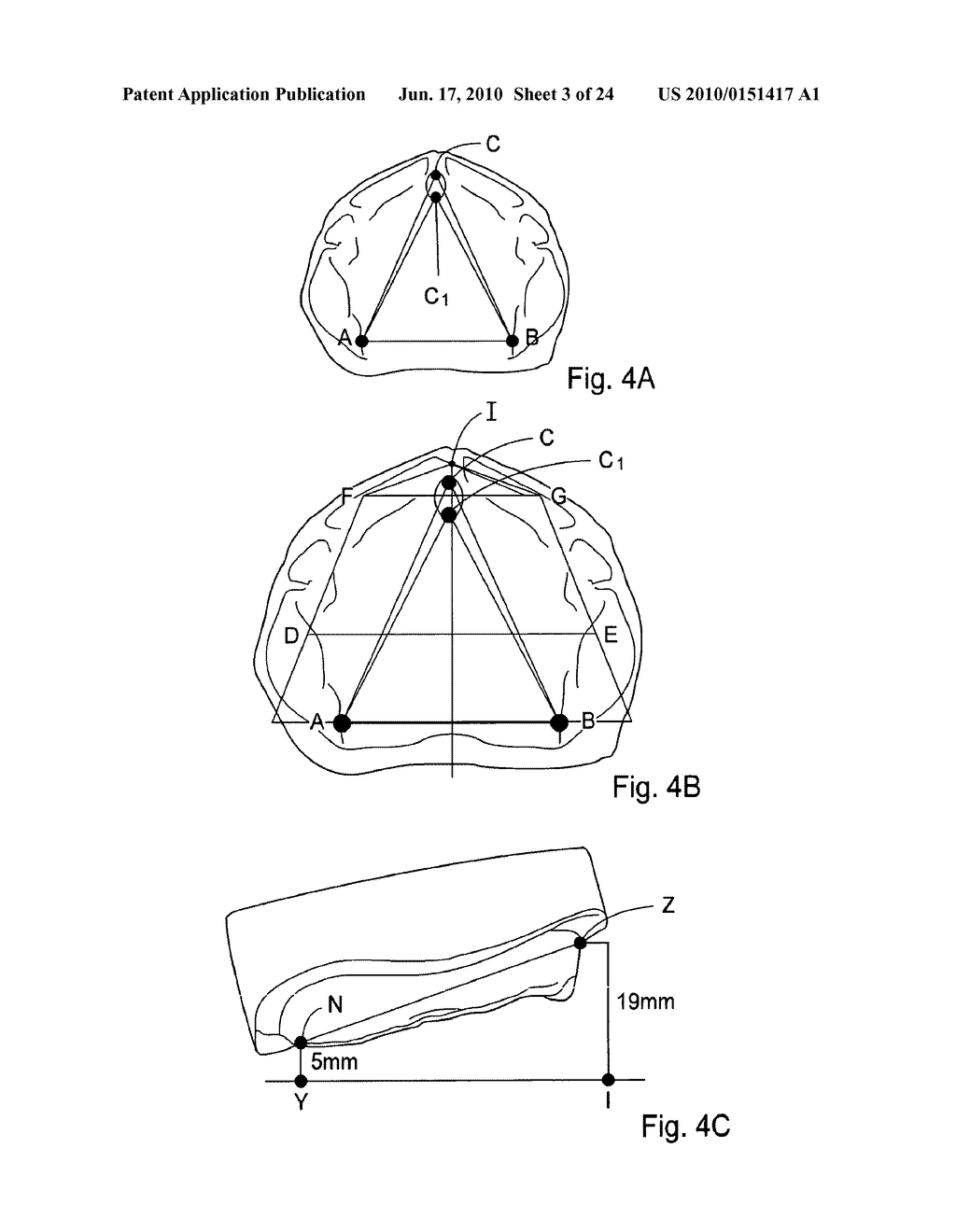 METHOD AND SYSTEM FOR DENTAL PLANNING - diagram, schematic, and image 04