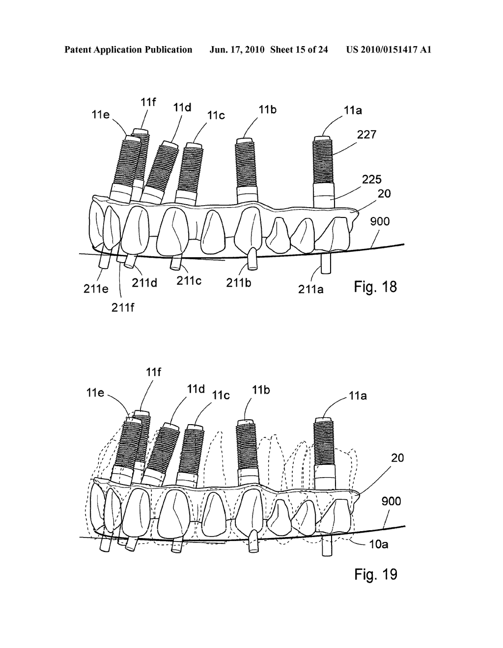 METHOD AND SYSTEM FOR DENTAL PLANNING - diagram, schematic, and image 16