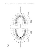 ARTIFICIAL TEETH diagram and image