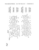 ARTIFICIAL TEETH diagram and image