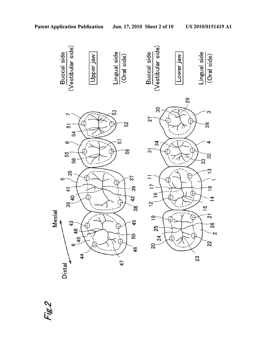 ARTIFICIAL TEETH - diagram, schematic, and image 03