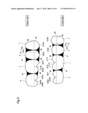 ARTIFICIAL TEETH diagram and image