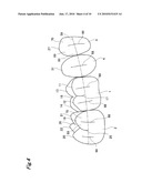 ARTIFICIAL TEETH diagram and image