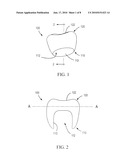 TEMPORARY RESTORATIONS AND RELATED METHODS diagram and image