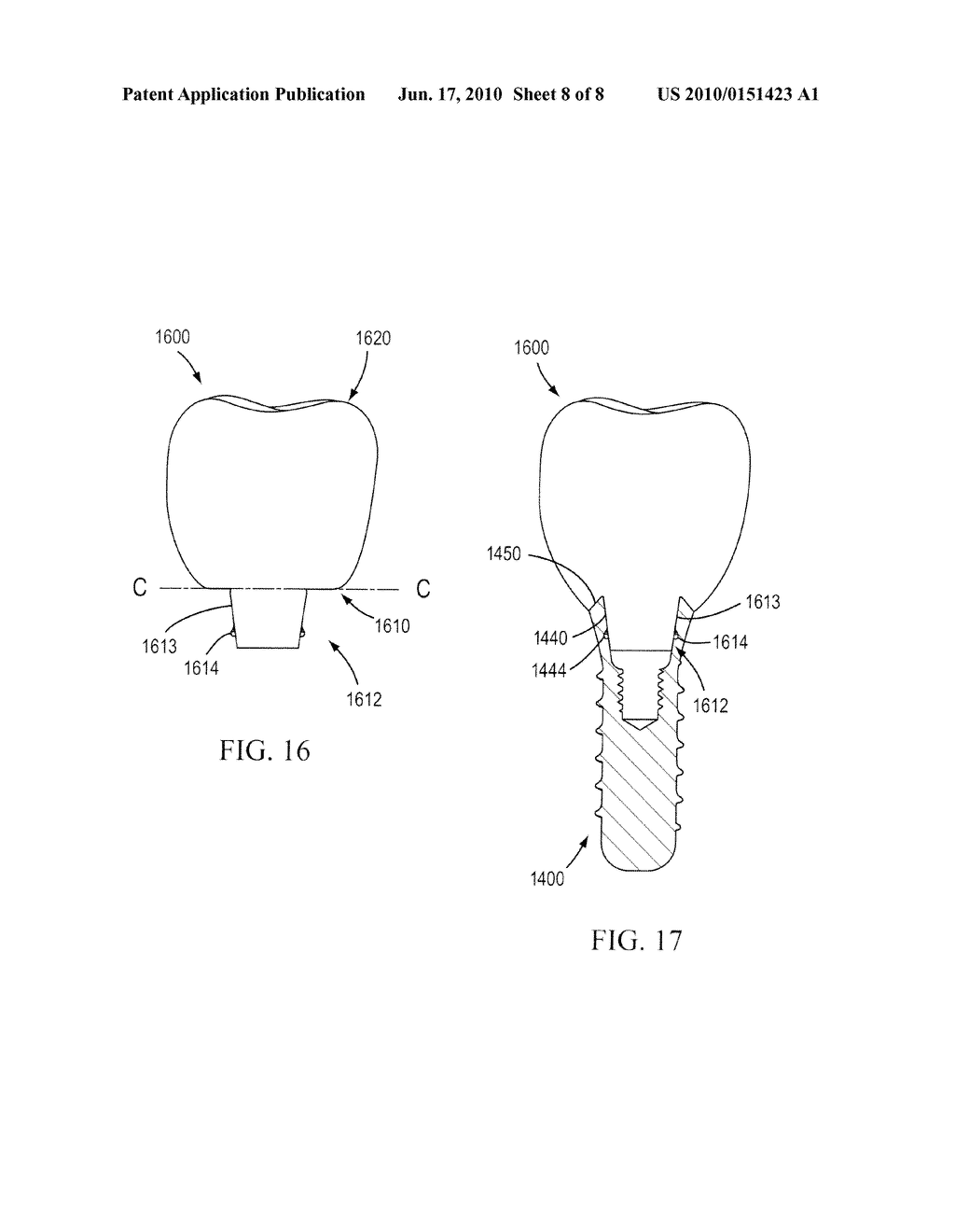 TEMPORARY RESTORATIONS AND RELATED METHODS - diagram, schematic, and image 09