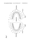 ARTIFICIAL MOLAR TEETH diagram and image