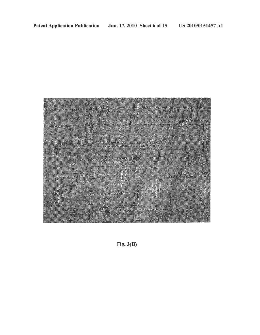 Detection of Unhealthy Cell and Uses Thereof - diagram, schematic, and image 07