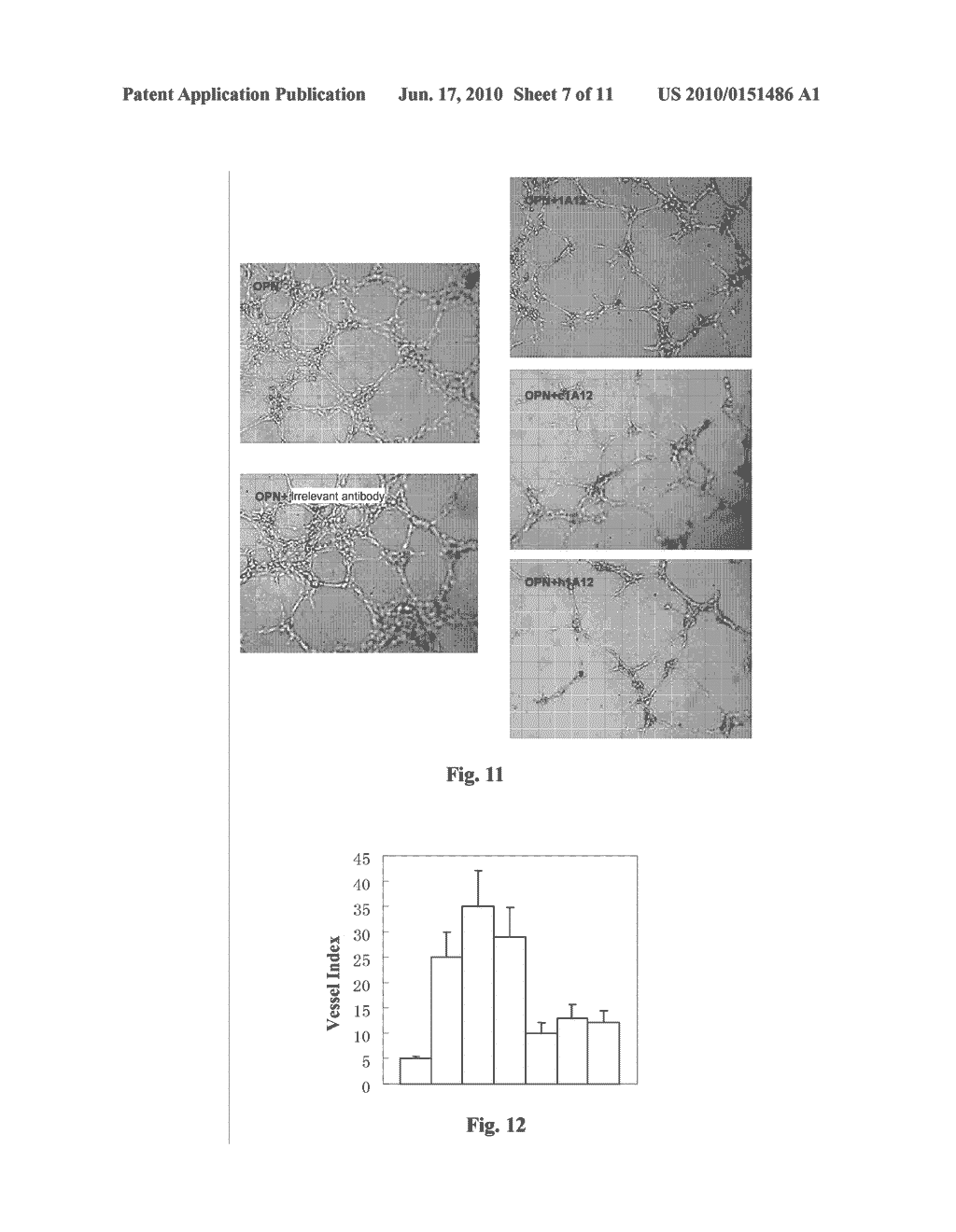 OSTEOPONTIN FUNCTIONAL EPITOPES, MONOCLONAL ANTIBODIES AGAINST THE EPITOPES AND USES THEREOF - diagram, schematic, and image 08