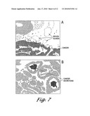 Forms of Prostate Specific Antigens and Methods for their Detection diagram and image