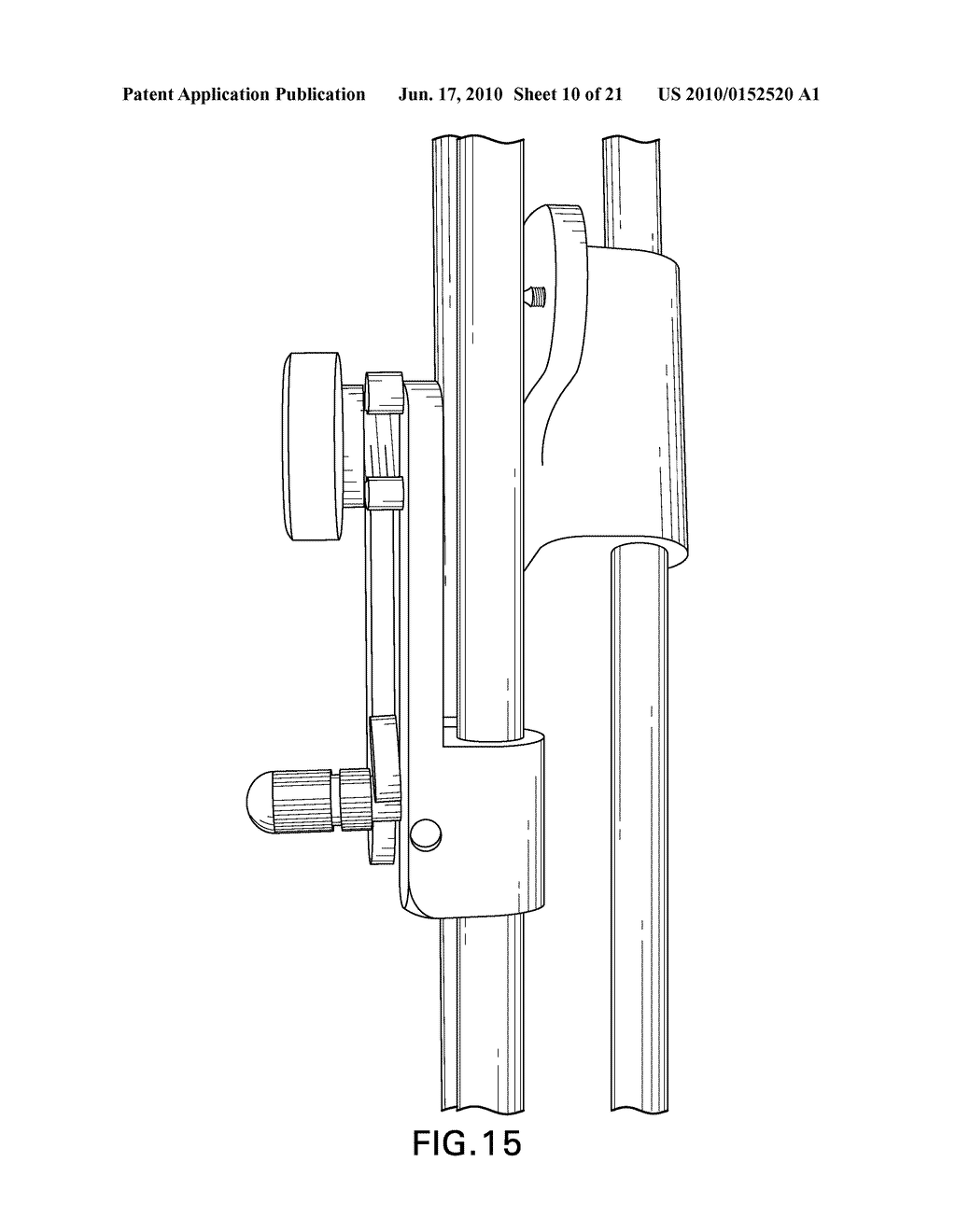 SPLIT-RING BRACHYTHERAPY DEVICE AND METHOD FOR CERVICAL BRACHYTHERAPY TREATMENT USING A SPLIT-RING BRACHYTHERAPY DEVICE - diagram, schematic, and image 11