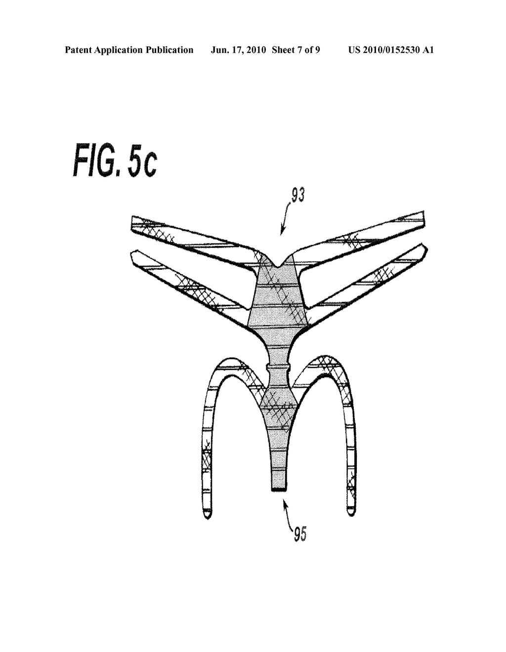 Biocompatible Fiber Based Device for Guided Tissue Regeneration - diagram, schematic, and image 08