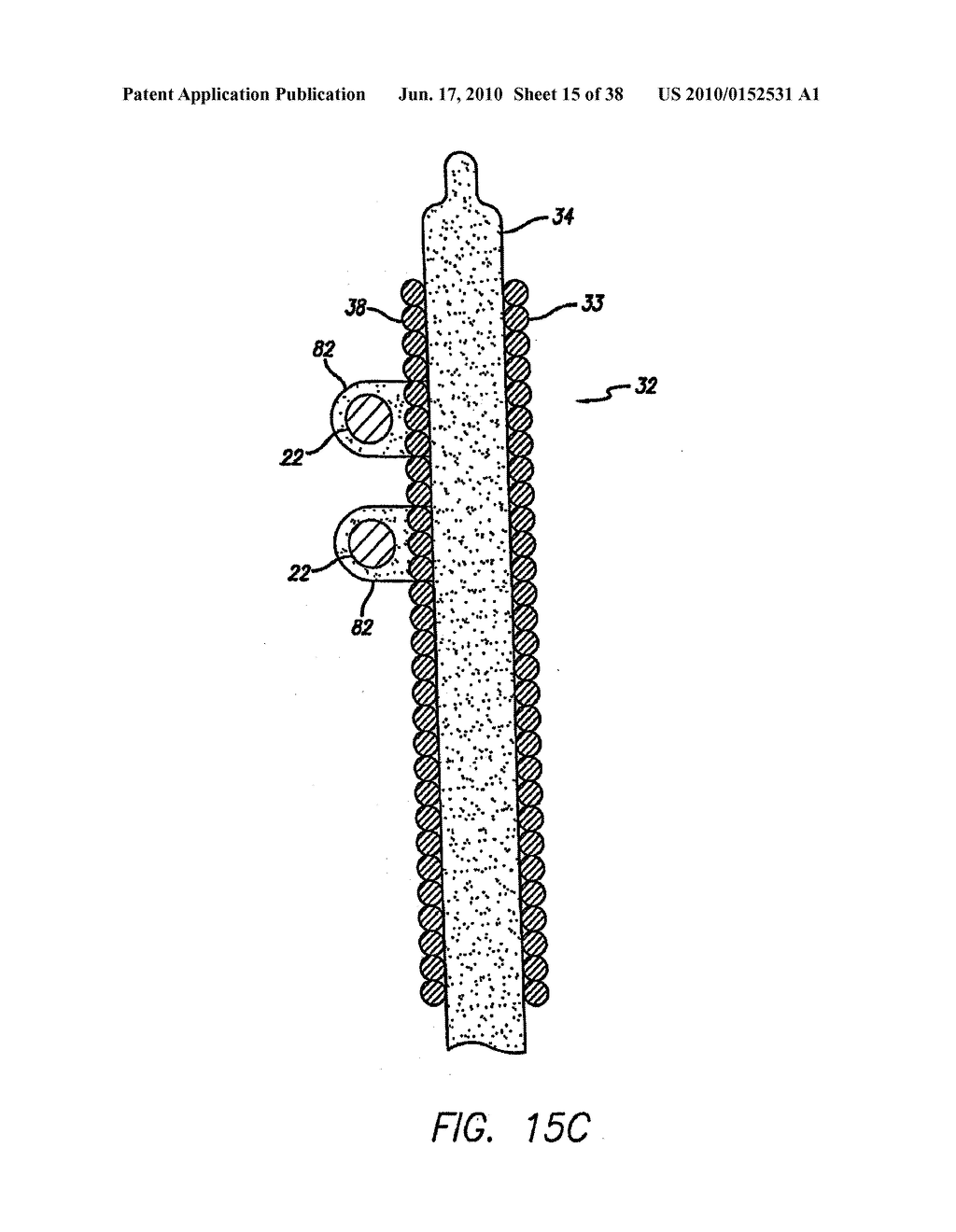 IMPLANTABLE MEDICAL DEVICE FOR DRUG DELIVERY AND METHOD OF USE - diagram, schematic, and image 16