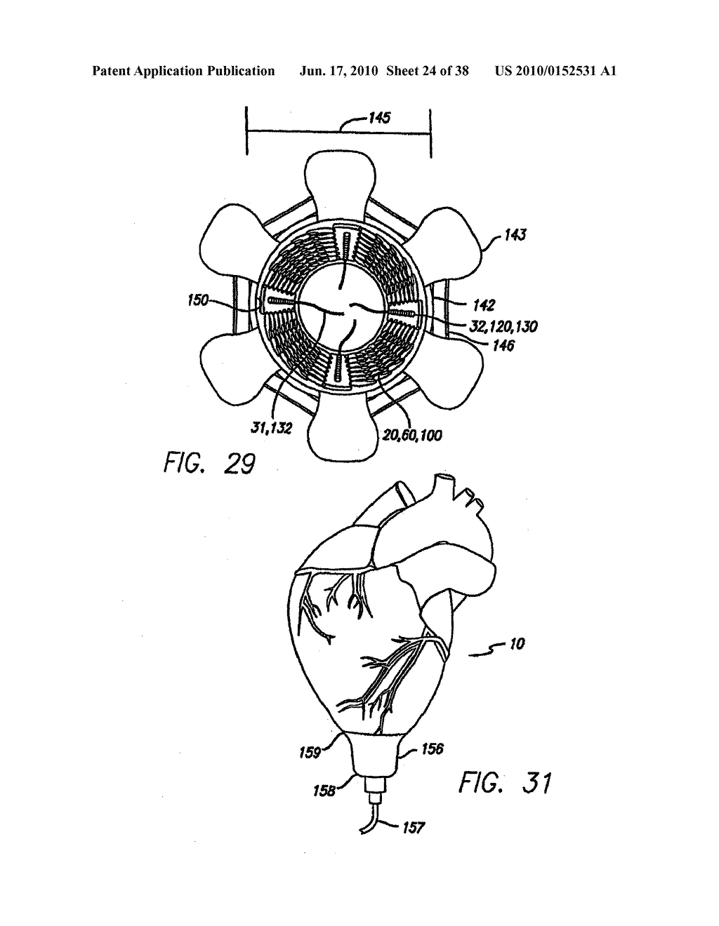 IMPLANTABLE MEDICAL DEVICE FOR DRUG DELIVERY AND METHOD OF USE - diagram, schematic, and image 25