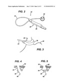 Gastric Band System with Esophageal Sensor diagram and image