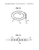 Gastric Band System with Esophageal Sensor diagram and image