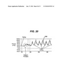 Gastric Band System with Esophageal Sensor diagram and image