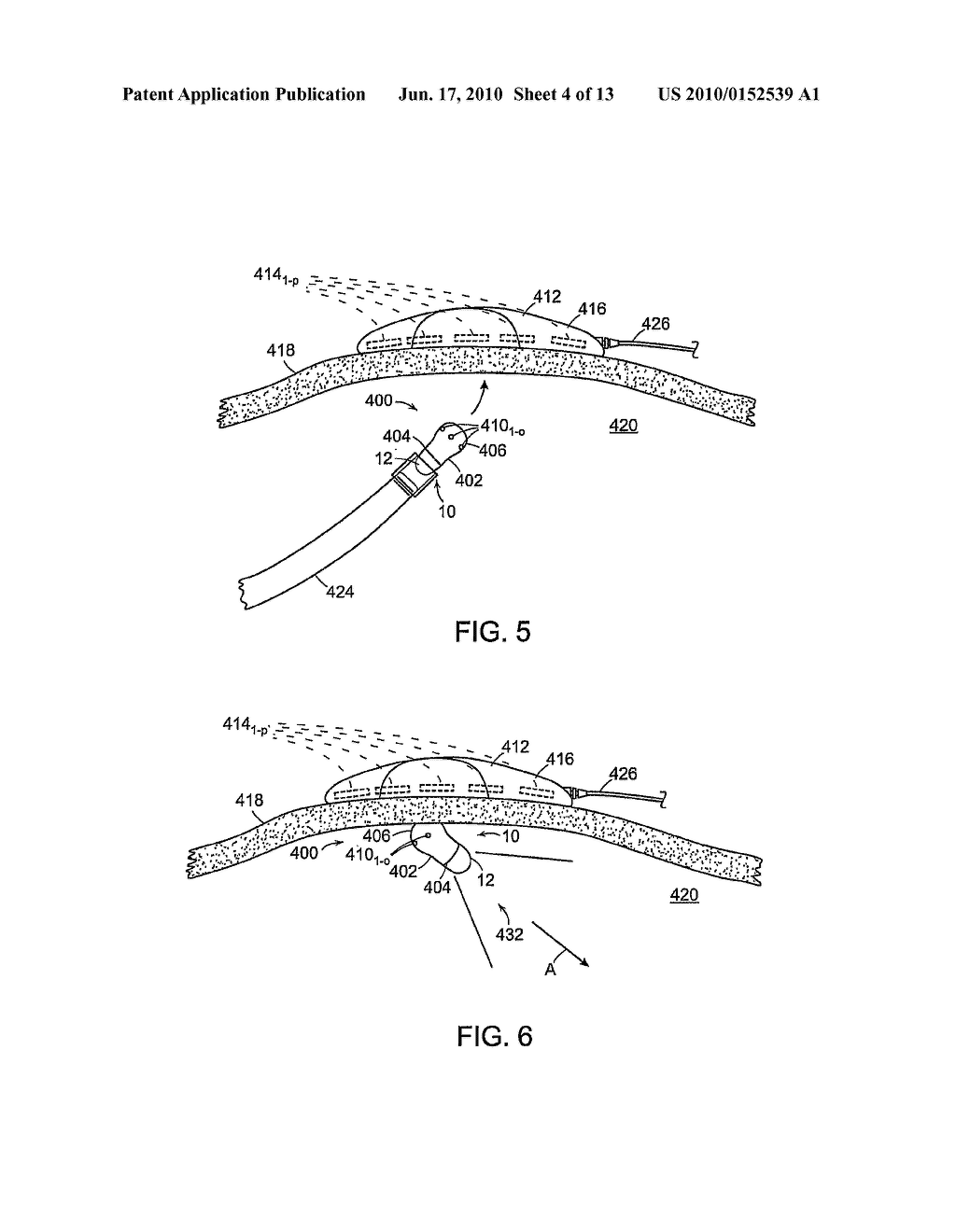 POSITIONABLE IMAGING MEDICAL DEVICES - diagram, schematic, and image 05