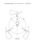 SYSTEMS AND METHODS FOR IDENTIFYING LANDMARKS ON ORTHOPEDIC IMPLANTS diagram and image