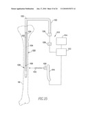 SYSTEMS AND METHODS FOR IDENTIFYING LANDMARKS ON ORTHOPEDIC IMPLANTS diagram and image