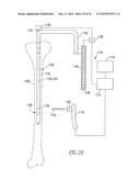 SYSTEMS AND METHODS FOR IDENTIFYING LANDMARKS ON ORTHOPEDIC IMPLANTS diagram and image