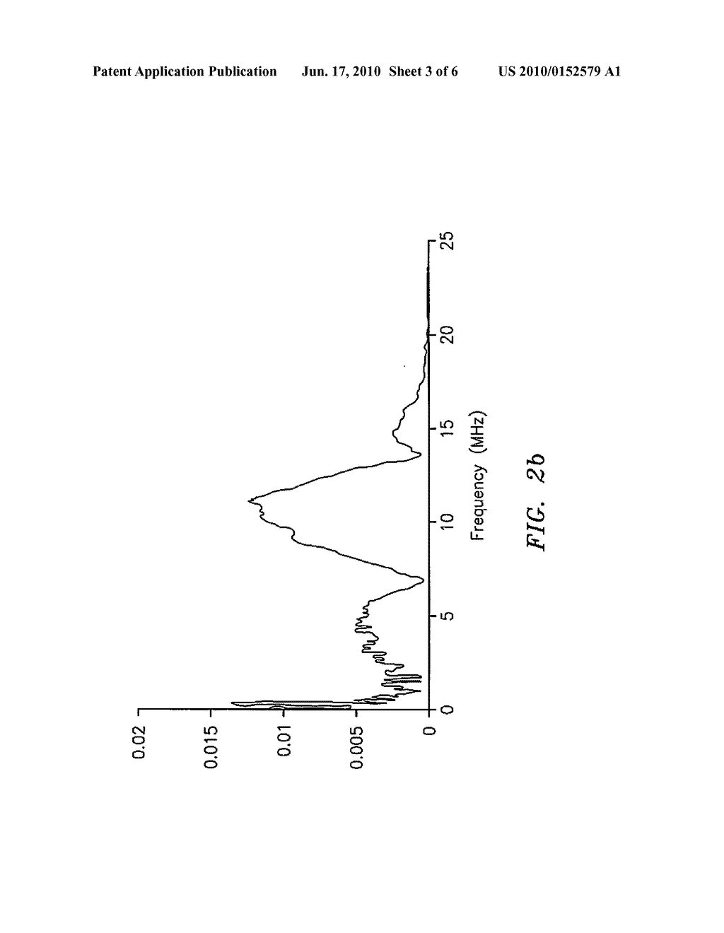 PORTABLE ULTRASONIC DEVICE AND ALGORITHMS FOR DIAGNOSIS OF DENTAL CARIES - diagram, schematic, and image 04