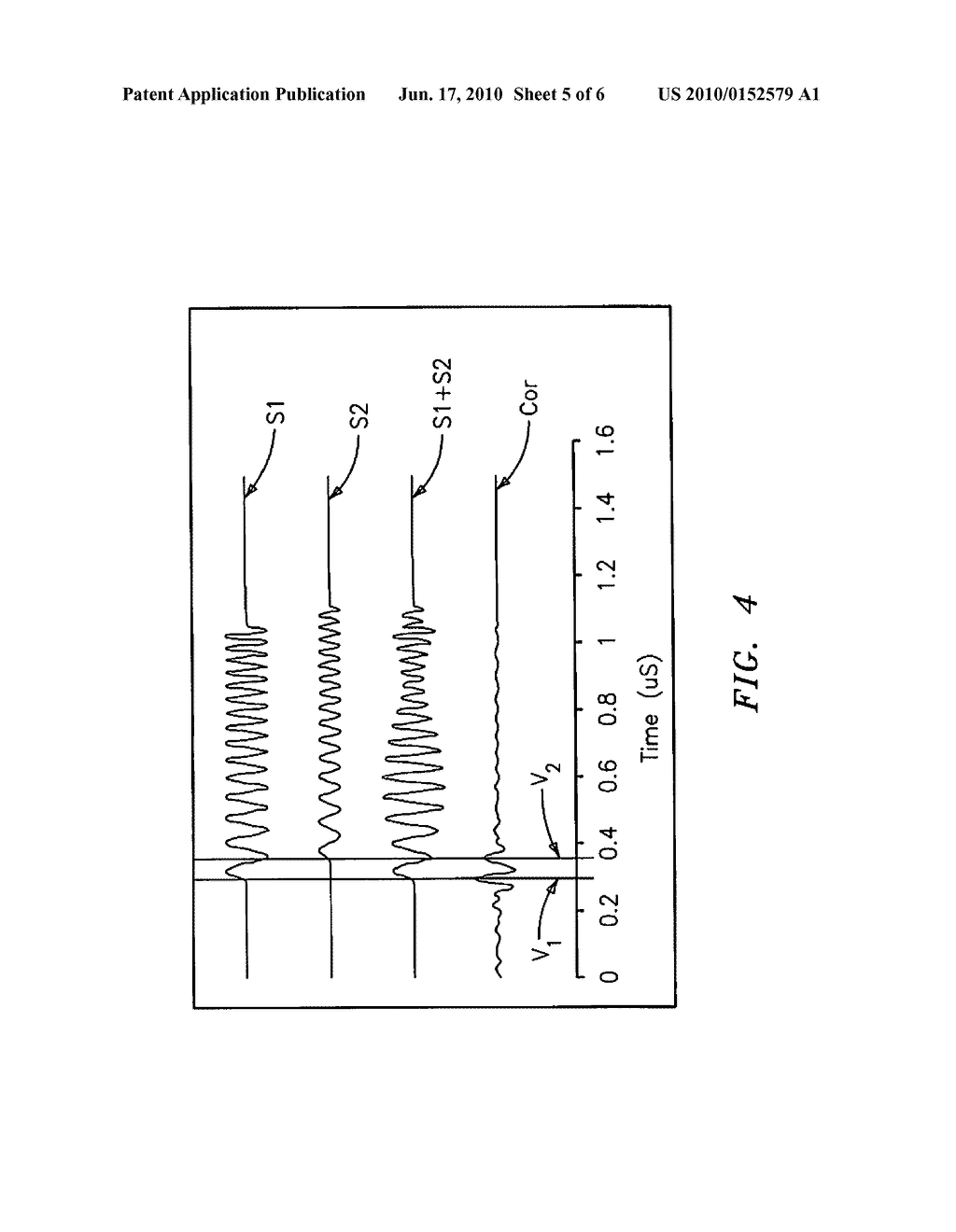 PORTABLE ULTRASONIC DEVICE AND ALGORITHMS FOR DIAGNOSIS OF DENTAL CARIES - diagram, schematic, and image 06