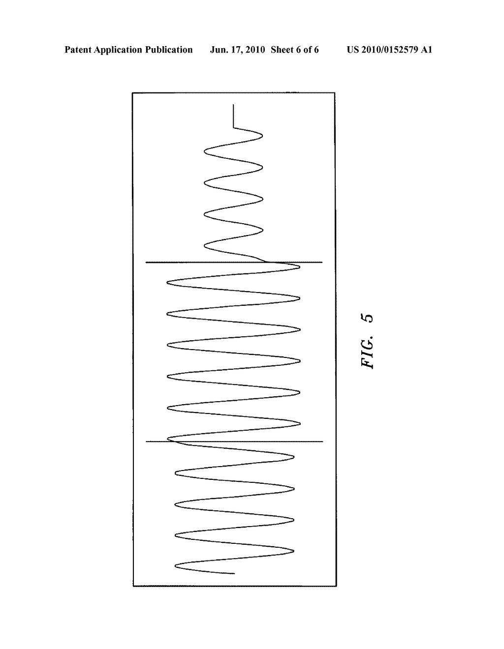 PORTABLE ULTRASONIC DEVICE AND ALGORITHMS FOR DIAGNOSIS OF DENTAL CARIES - diagram, schematic, and image 07