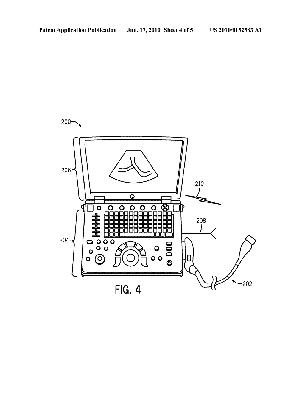 MEDICAL IMAGING SYSTEM AND METHOD CONTAINING ULTRASOUND DOCKING PORT - diagram, schematic, and image 05