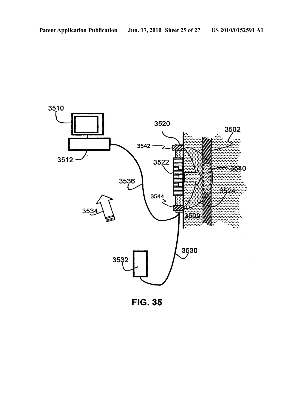 APPARATUS AND METHOD FOR NON-INVASIVE AND MINIMALLY-INVASIVE SENSING OF PARAMETERS RELATING TO BLOOD - diagram, schematic, and image 26