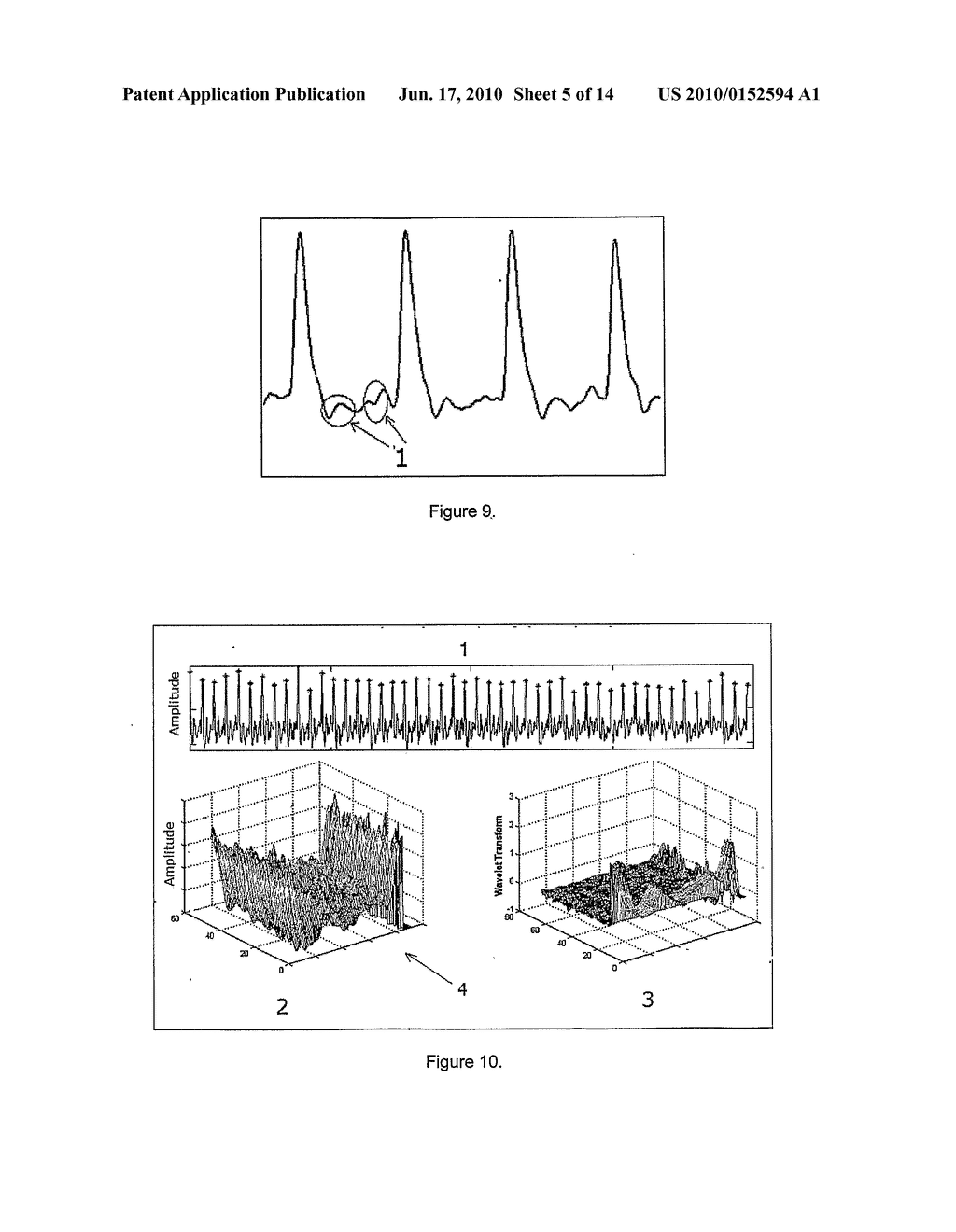 NON-INVASIVE DEVICE NADI TARANGINI USEFUL FOR QUANTITAVE DETECTION OF ARTERIAL NADI PULSE WAVEFORM - diagram, schematic, and image 06