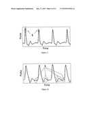 NON-INVASIVE DEVICE NADI TARANGINI USEFUL FOR QUANTITAVE DETECTION OF ARTERIAL NADI PULSE WAVEFORM diagram and image