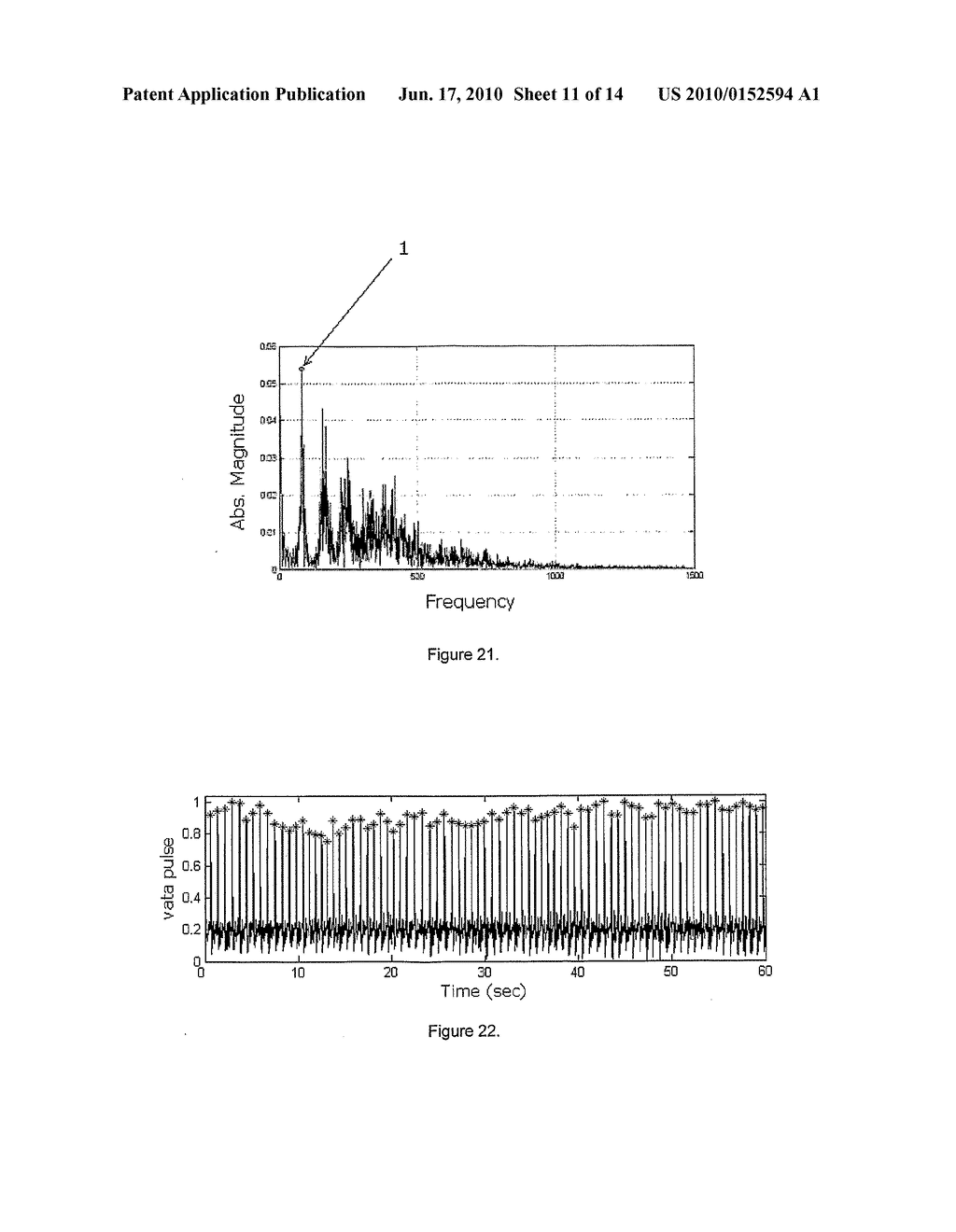 NON-INVASIVE DEVICE NADI TARANGINI USEFUL FOR QUANTITAVE DETECTION OF ARTERIAL NADI PULSE WAVEFORM - diagram, schematic, and image 12