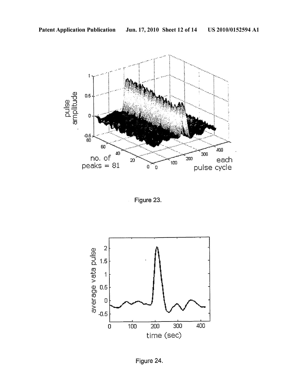 NON-INVASIVE DEVICE NADI TARANGINI USEFUL FOR QUANTITAVE DETECTION OF ARTERIAL NADI PULSE WAVEFORM - diagram, schematic, and image 13