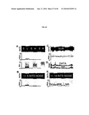 AUTOMATED NOISE REDUCTION SYSTEM FOR PREDICTING ARRHYTHMIC DEATHS diagram and image