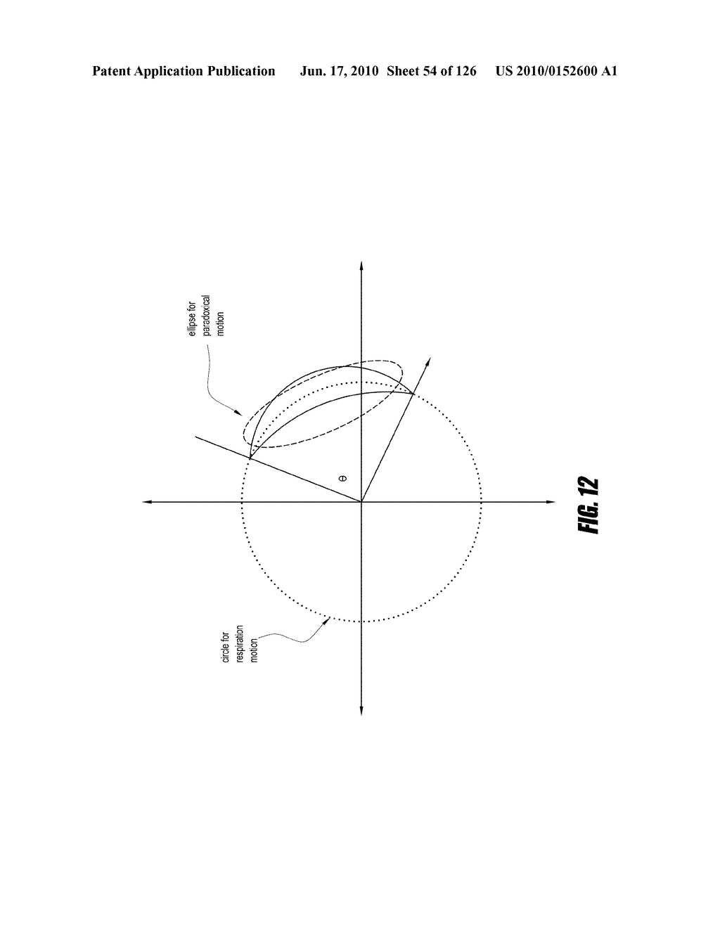 NON-CONTACT PHYSIOLOGIC MOTION SENSORS AND METHODS FOR USE - diagram, schematic, and image 55