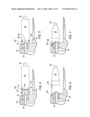 TISSUE REMOVAL DEVICE FOR NEUROSURGICAL AND SPINAL SURGERY APPLICATIONS diagram and image